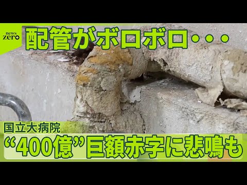 【“400億”巨額赤字に】「もう手立てはない」と悲鳴も 国立大病院 “過去最大の危機” 医療機器など更新できず