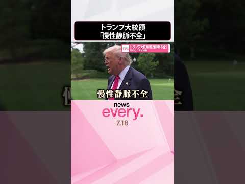 【トランプ大統領】「慢性静脈不全」足にむくみで検査 どんな病気なのか #shorts