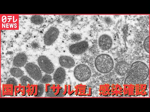 【ライブ】ニュースまとめ　国内初「サル痘」の感染者を確認/“サル痘”『極めて異常』ナゼ世界で感染拡大 など（2022年7月25日）