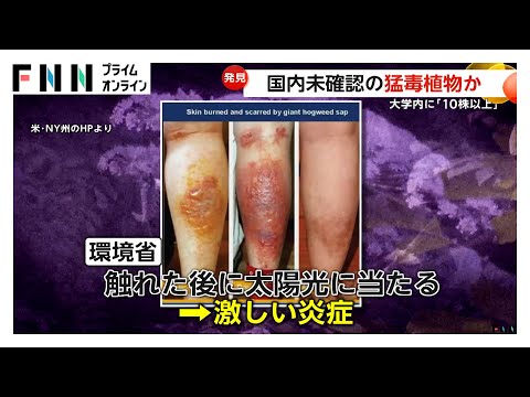 「触れてはダメ」国内未確認の猛毒植物を北海道大学構内で10株以上発見…白く背の高い花　接触後に太陽光に当たると激しく炎症